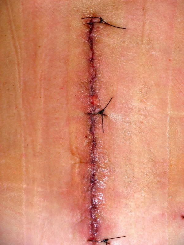 backsurgery240001.jpg