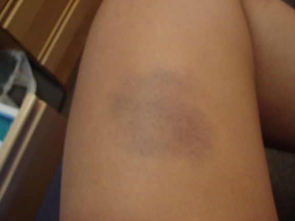 Image hosting by Photobucket