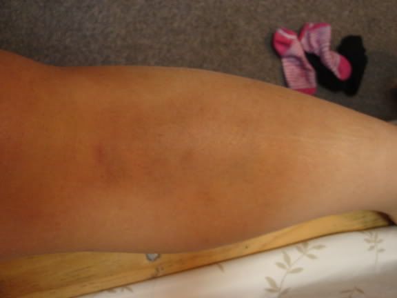 Image hosting by Photobucket