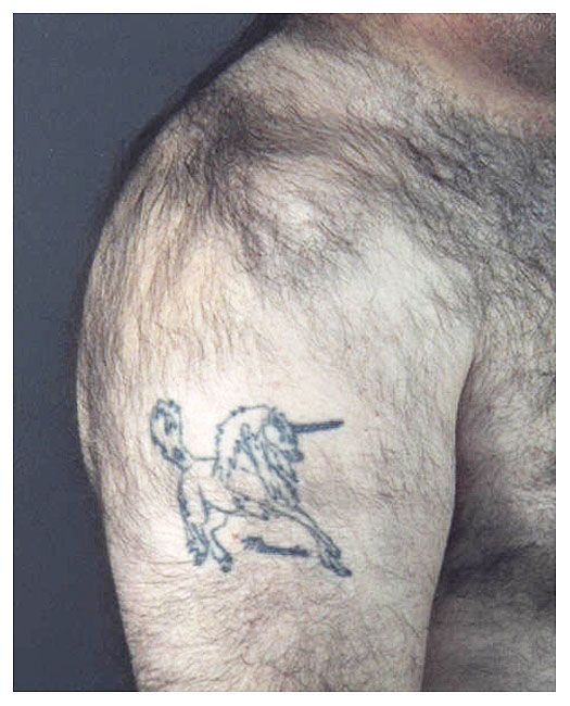 I found this great pic of your unicorn tattoo. Charlie's new tat